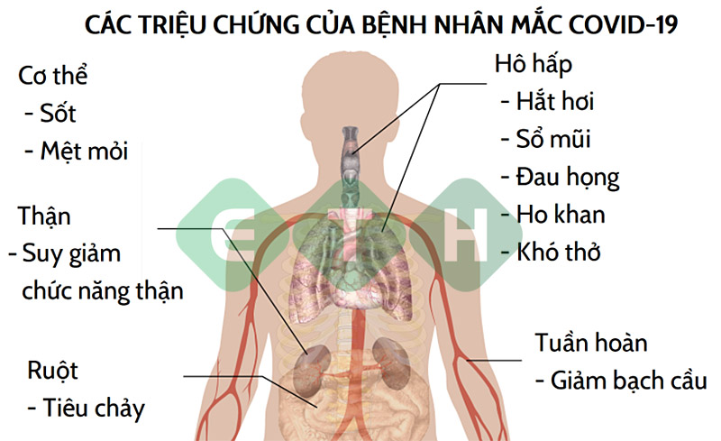 Hình minh họa 3 - Phòng chống Virus CORONA (COVID-19): Những triệu chứng và cách phòng tránh cần biết